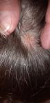 Недифференцированное новообразование волосистой части головы фото 2