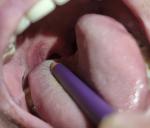 Фиолетовый синяк в горле фото 1
