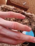 Грубость, сухость, трещины на изгибах пальцев фото 1