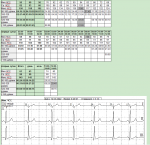 Холтеровское мониторирование заключение фото 4