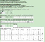 Холтеровское мониторирование заключение фото 3