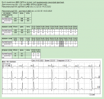 Холтеровское мониторирование заключение фото 1