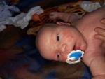 Сыпь на теле и лице у ребёнка 1 месяц и 10 дней фото 3