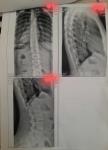 Рентген спины фото 2