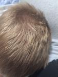 Неоавномерное покрытие волос фото 2
