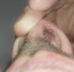 Образования в носовой полости фото 2