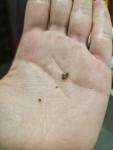 Отпадает невус фото 2