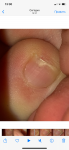 Маленькая царапина на ногте фото 3