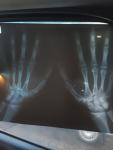 Рентген лучезапястных суставов фото 1