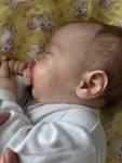 Акне новорожденных или аллергия? фото 2