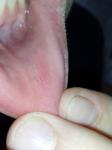 Странное воспаление на внутренней стороне губы фото 2