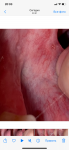 Слизистая рта после операции фото 5