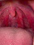 Болит горло без орви фото 2