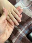 Деформация ногтей у ребенка фото 2