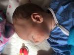 Акне новорождённых тли аллергия фото 3