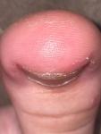 Полоска посередине ногтя, изменение лунулы фото 4