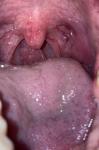 2 недели красное горло без других симптомов фото 1