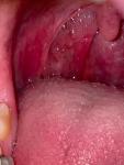 Болит горло без орви фото 3