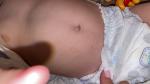 Коричневые пятна на теле у ребёнка фото 4