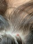 Пятна на волосистостей части головы фото 3