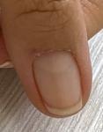 Продольная линии на ногтях фото 1