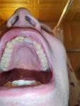 Воспаление в полости рта, после увулита фото 3
