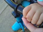 Шишка на пальце у ребенка, твердая фото 1