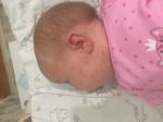 Высыпание на лице у новорождённого фото 1