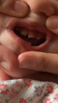 Плохие молочные зубы фото 1