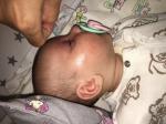 Аллергия или сыпь новорожденного фото 1
