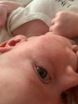 Сыпь на лице новорождённого фото 2