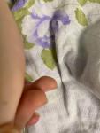 Опухли подушечки пальцев у ребёнка 7 лет фото 4