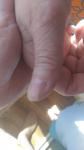 Тёмная полоса под ногтем на пальце руки фото 3