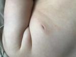 Пятна на теле у грудничка фото 3
