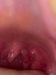 Темные точки на горле и продолжительные боли фото 2