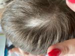 Отсутствие волос на голове ребенка фото 2