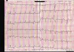 Помогите понять кардиограмму фото 3