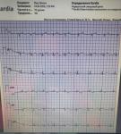 Головокружение и низкое давление фото 1