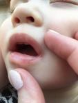 Пузырьки на губах и во рту у ребёнка фото 1