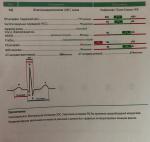 Укорочение интервала pq фото 1