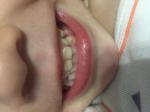 Портятся зубы у ребёнка фото 2