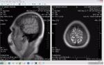 Помогите описать МРТ головного мозга фото 5