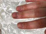 Полоска на ногтевой пластине фото 2