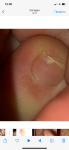 Маленькая царапина на ногте фото 4