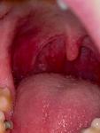 Болит горло без орви фото 4