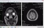Помогите описать МРТ головного мозга фото 6