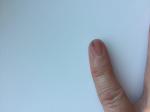 Что может быть с моим ногтем? фото 1