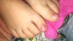 Ребёнок прищемил большой палец ноги фото 2