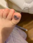 Ребенок ушиб палец ноги фото 3