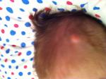 Шишка на голове у ребенка 4 месяца фото 1